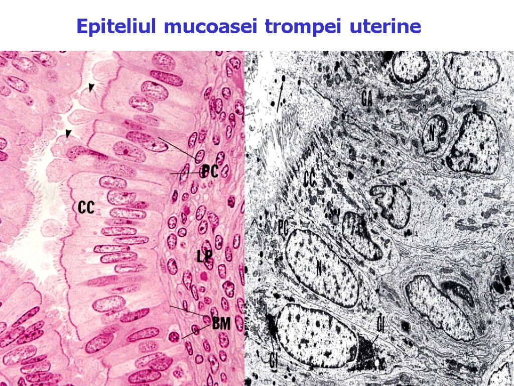 Epiteliul mucoasei trompei uterine